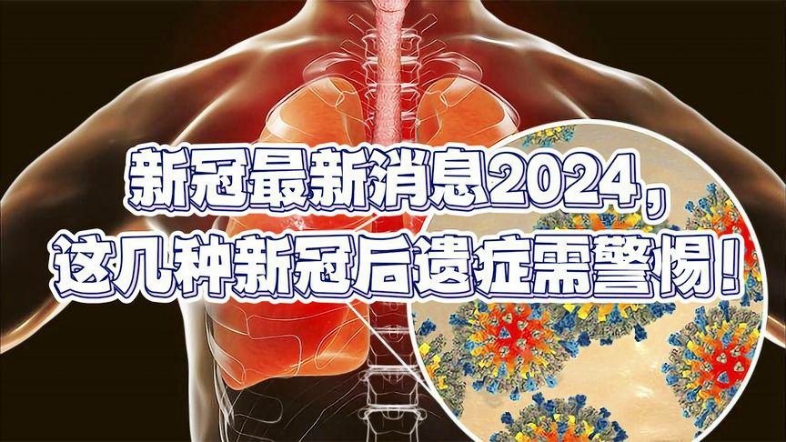 新冠病毒2024年最新消息,最新解答解释定义_Pixel92.413